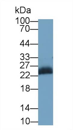 JAM-A Antibody (C11)