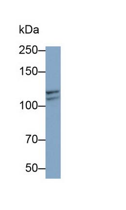 Insulysin/IDE Antibody (C2)