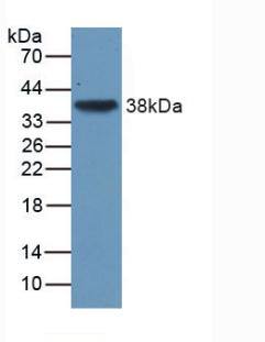 TGF-beta 3 Antibody (C1)