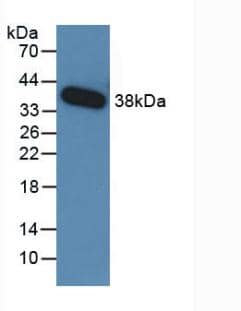 TGF-beta 3 Antibody (C5)