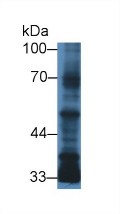 TGF-beta 3 Antibody (C5)