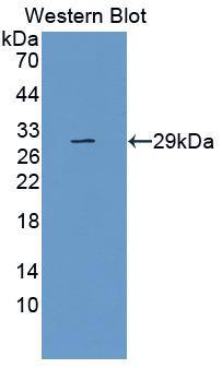 TLR5 Antibody (8-1#)
