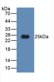 TLR5 Antibody (C6)
