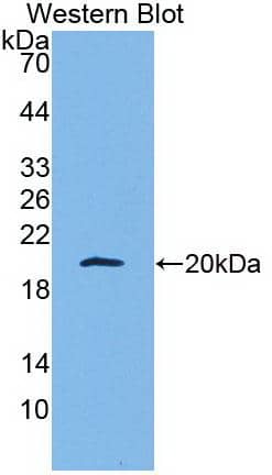 Apolipoprotein A5 Antibody (C11)