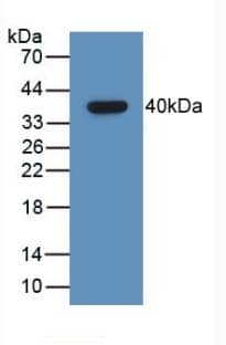 GHRH Antibody (C2)