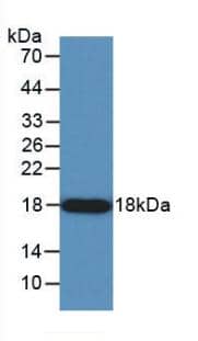 Angiogenin Antibody (C9)