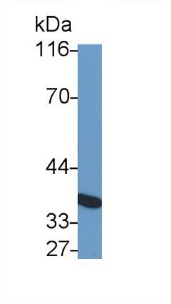 IL-10 R beta Antibody (C9)