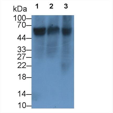 Reduced Folate Carrier/SLC19A1 Antibody (C5)