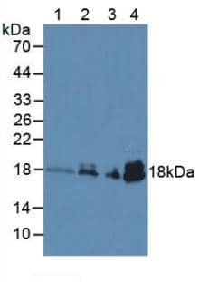 Troponin C (cardiac) Antibody (C5)