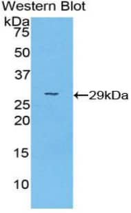 PRKAG2 Antibody