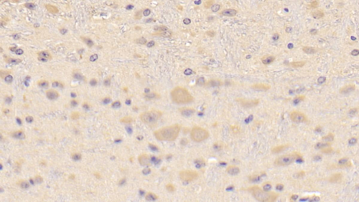 CRYBA1 Antibody