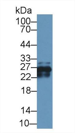 CRYBA1 Antibody