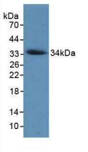 Collagen VII Antibody (C7)