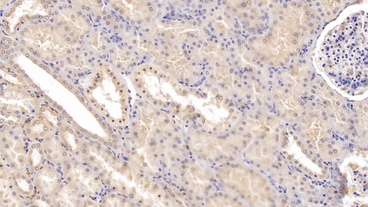 Tie-1 Antibody (C2)