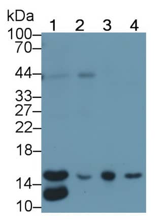 RBX1 Antibody (C10)