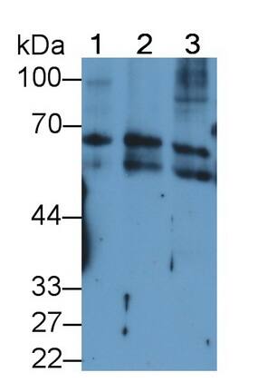 Cytokeratin 2 Antibody (D2)