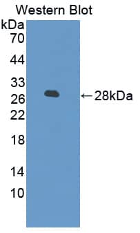 PRKAG3 Antibody