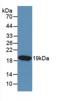 KISS1 Antibody (C1)