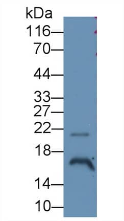 Angiogenin Antibody (C5)