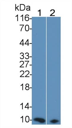 S100A/B Antibody (C13)