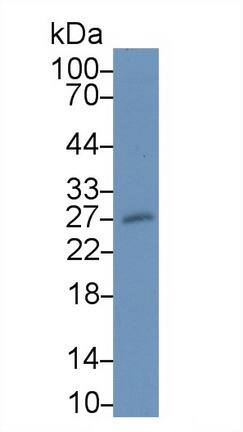 MOG Antibody (D2)