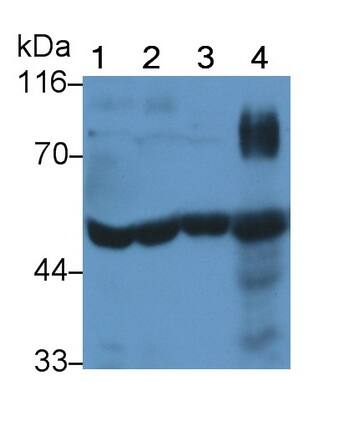 t-Plasminogen Activator/tPA Antibody (K12)