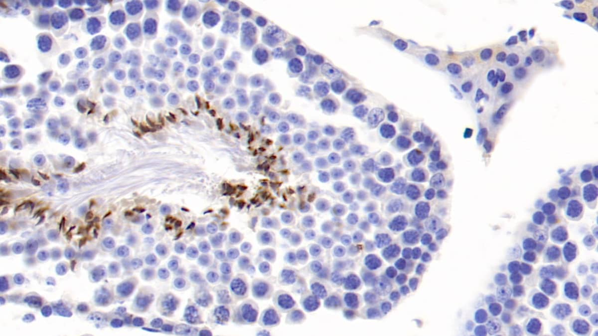 COMP/Thrombospondin-5 Antibody (C1)