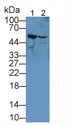 TUBB6 Antibody