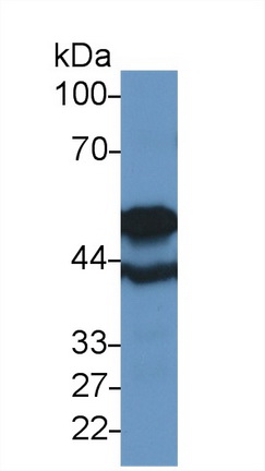 TUBB6 Antibody