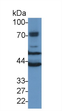 TUBB6 Antibody