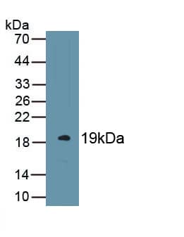 EPCR Antibody (C5)