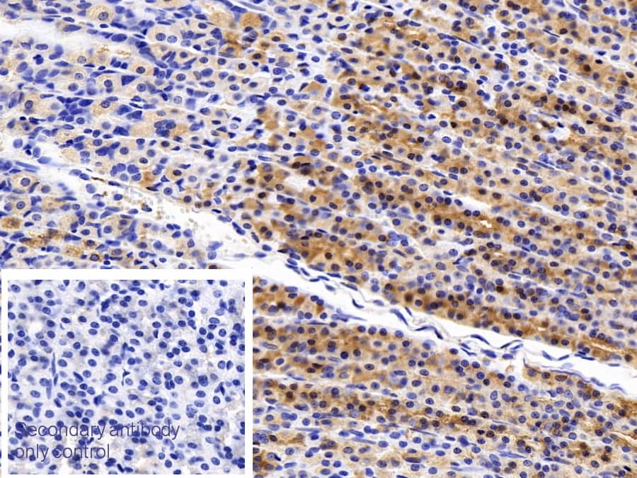 TFF2 Antibody (1-2#)