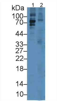 Lactoperoxidase Antibody (15#)