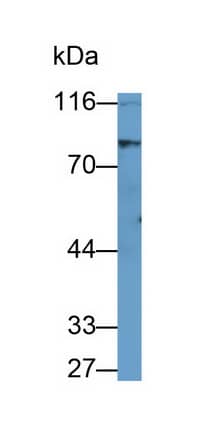 Hormone-sensitive Lipase/HSL Antibody (C1)