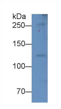 Complement Component C5a Antibody (D4)