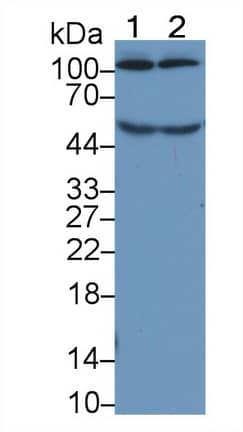 Complement Component C5a Antibody (D4)