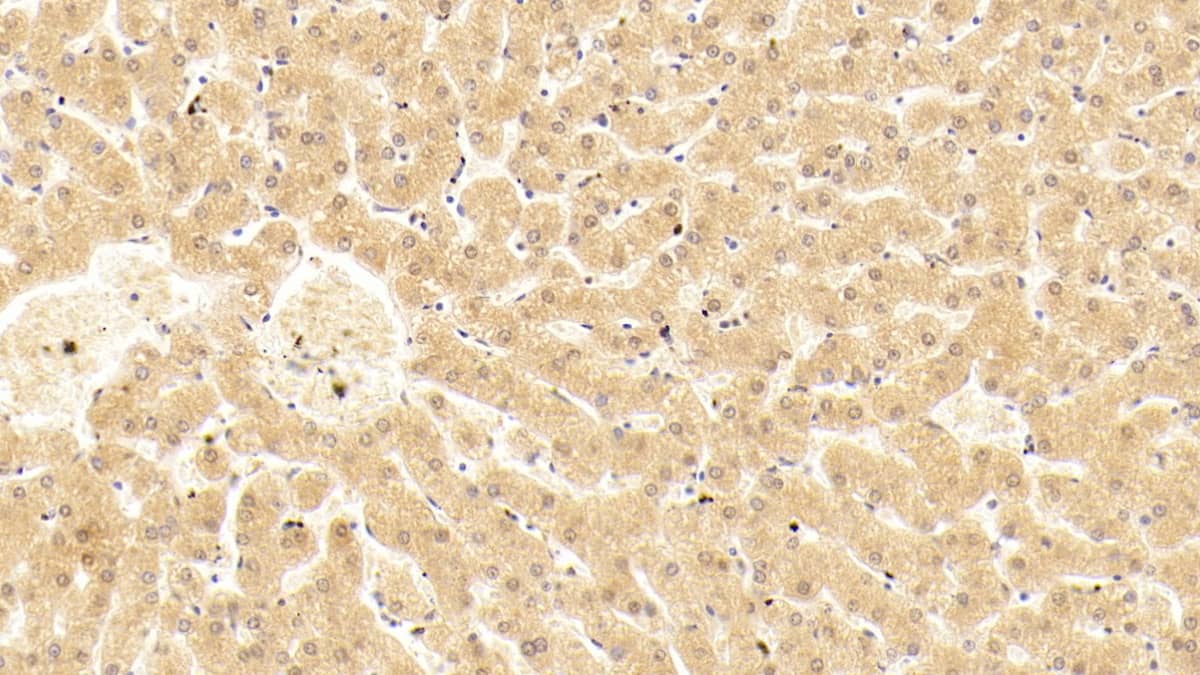 Complement Component C5a Antibody (D5)