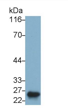 Placental Lactogen/CSH1 Antibody (C3)