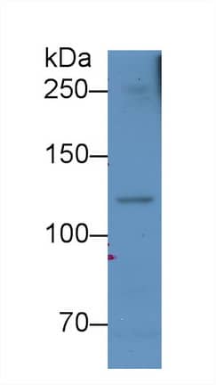 Complement Component C5a Antibody (D2)