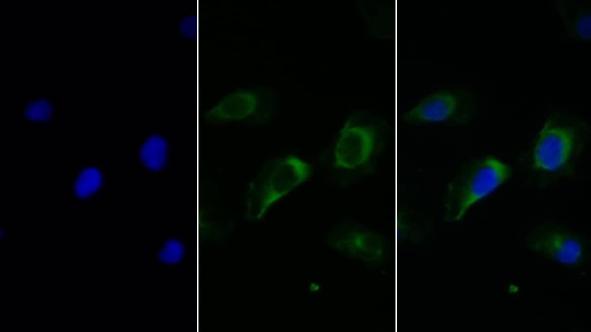 Fc gamma RIIIB/CD16b Antibody (C1)