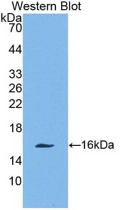 Galectin-10 Antibody (C2)