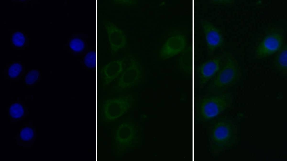 Heparanase/HPSE Antibody (C303)