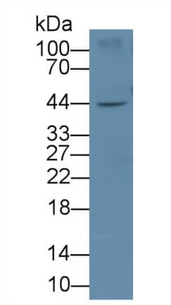 IL-19 Antibody (E5)