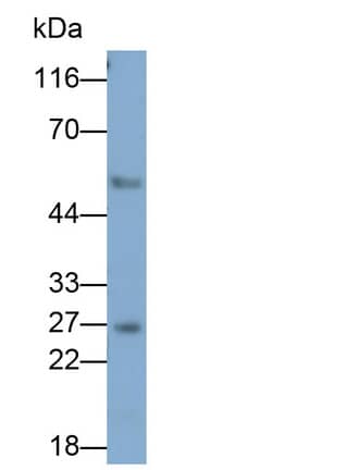 Granzyme K Antibody (C3)