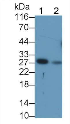 Granzyme K Antibody (C13)