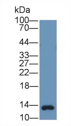 Gastrin Antibody (C25)