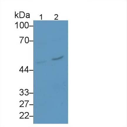 Serpin B3/SCCA1 Antibody (D6)