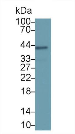 Serpin B3/SCCA1 Antibody (D5)