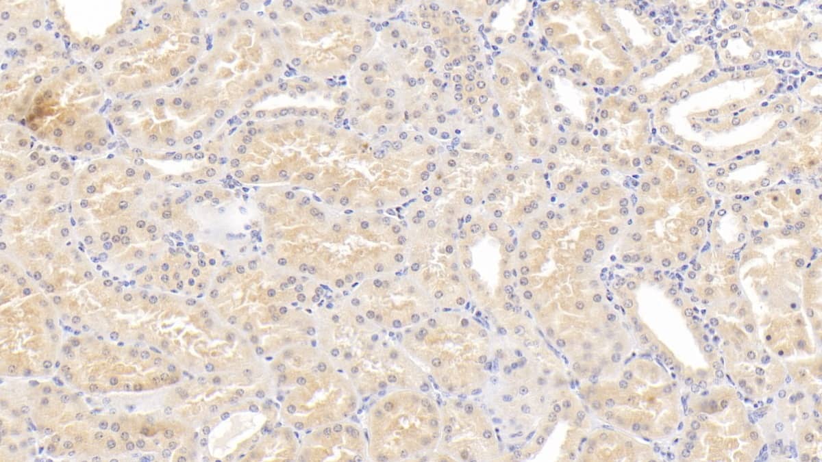 LBP Antibody (C2)