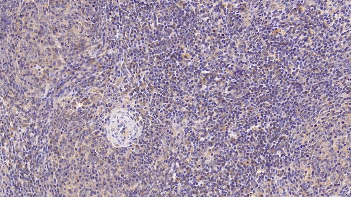 CD3 delta Antibody (C13)